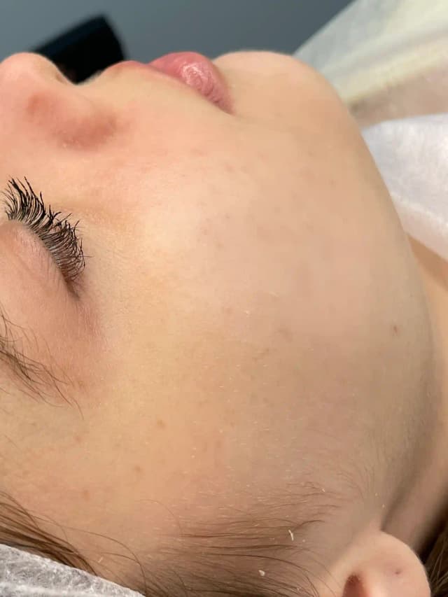 After image for 1.name