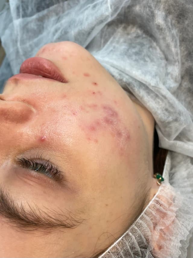 Before image for 1.name