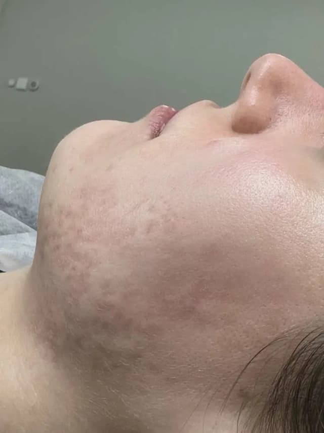 After image for 2.name