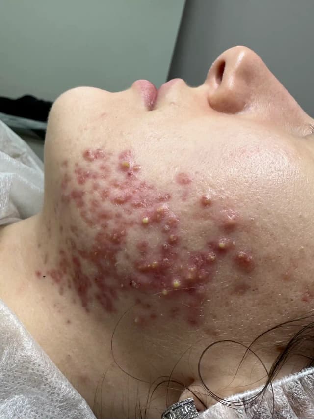 Before image for 2.name