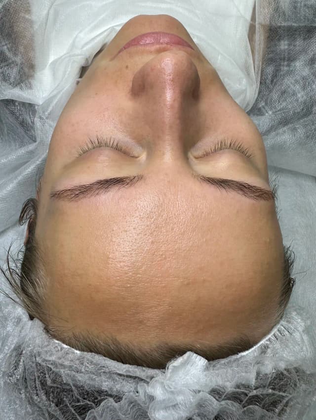 After image for 3.name