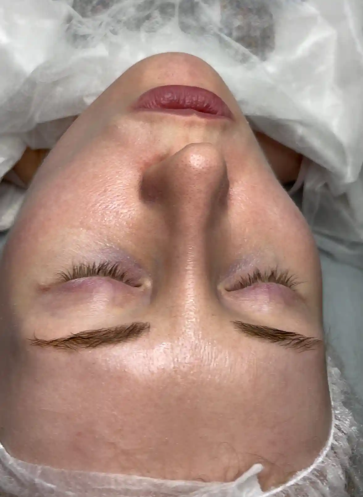 After image for 4.name