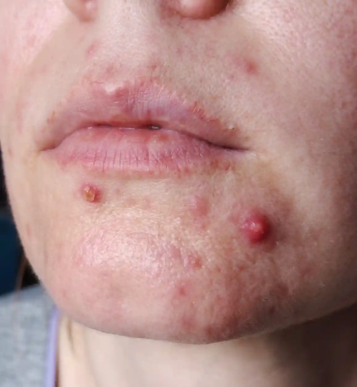 Before image for 5.name